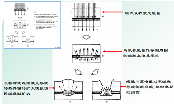 激光投影安全吗？有评价标准吗？ 